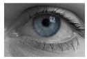Trastornos de la cavidad ocular | Recurso educativo 81471