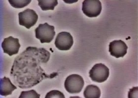 Glóbulo Branco Persegindo unha Bacteria. | Recurso educativo 741155